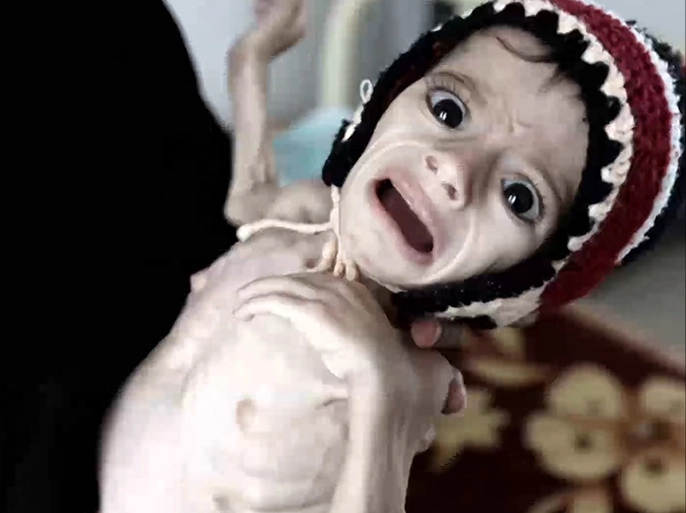  اليونيسف : حياة ملايين الأطفال باليمن في خطر
