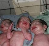 ولادة ثلاثة توائم في صنعاء