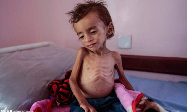 الأمم المتحدة:نحتاج4 مليارات دولار لتجنب مجاعة في اليمن