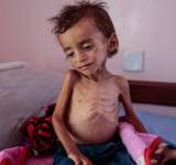 الأمم المتحدة:نحتاج4 مليارات دولار لتجنب مجاعة في اليمن