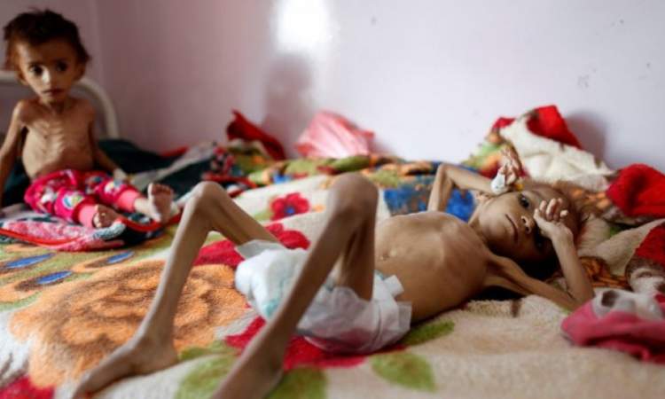 منظمات أممية:نصف أطفال اليمن عرضة للموت