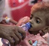 بشهادة بريطانية..اليمن تواجه أسواء أزمة انسانية