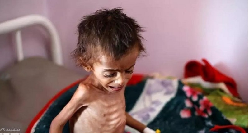 الحوثي يحمل دول العدوان مسؤولية المجاعة في اليمن