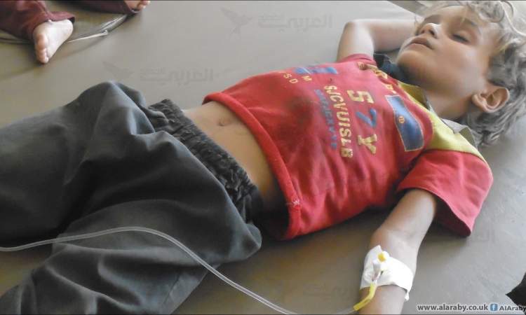 الحوثي: 400 ألف طفل مهددون بالموت