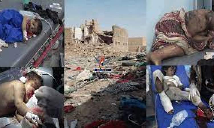 العدوان ينتهك حقوق الاطفال في اليمن (صور)
