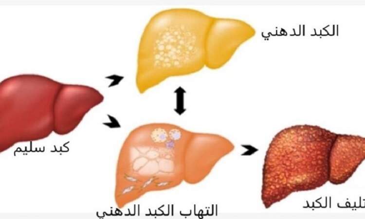  7 أطعمة مجربة تجدد أنسجة الكبد وتطهره من السموم