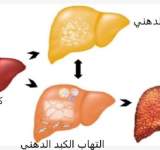  7 أطعمة مجربة تجدد أنسجة الكبد وتطهره من السموم