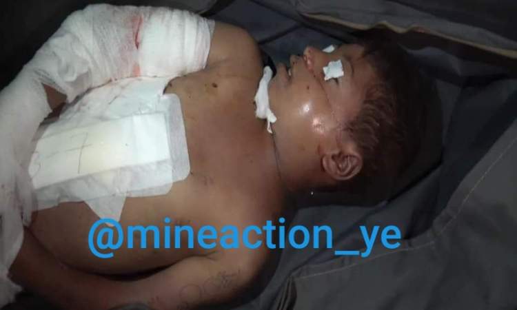 مأساة طفل يمني افقدته قنابل العدوان بصرة
