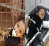 صور مؤلمة.. أسد يلتهم يد طفلة يمنية