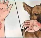اعراض داء الكلب الخطيرة عند الانسان