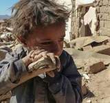 في اليمن ليست حربا منسية بل تم تجاهلها عمدا