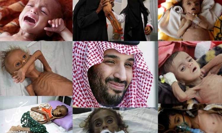 مركز امريكي: رغم الهدنة! شمال اليمن محاصر .. بلا رواتب .. وعرضة للمجاعة