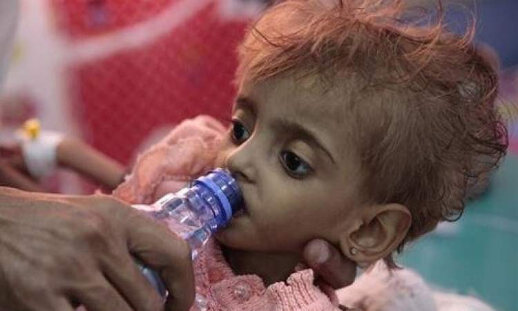 وكالة إيطالية: عدد مرعب لوفيات الاطفال في اليمن