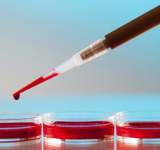 لأول مرة في العالم.. نقل دم للبشر تم تصنيعه في المختبر