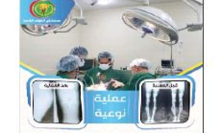 فريق طبي في مستشفى القوات الخاصة ينجح في تركيب مفصل صناعي بالركبة لمريض
