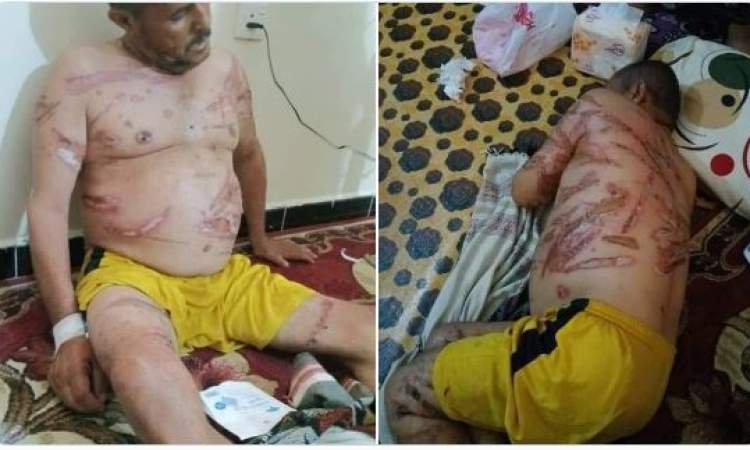 تفاصيل جديدة حول جريمة التعذيب الوحشي بحق المواطن محمد مهدي
