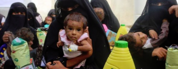 تقريرٌ دولي: ثلثي سكان اليمن بحاجة للمساعدات