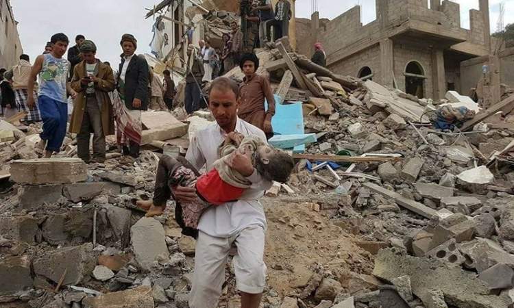 اكثر من 49 الف ضحايا العدوان على اليمن 