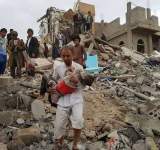 اكثر من 49 الف ضحايا العدوان على اليمن 