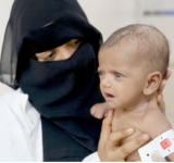 أوتشا:17 مليون يمني بحاجة للمساعدات