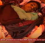 إصابة 10 مواطنين بنيران العدو السعودي في صعدة